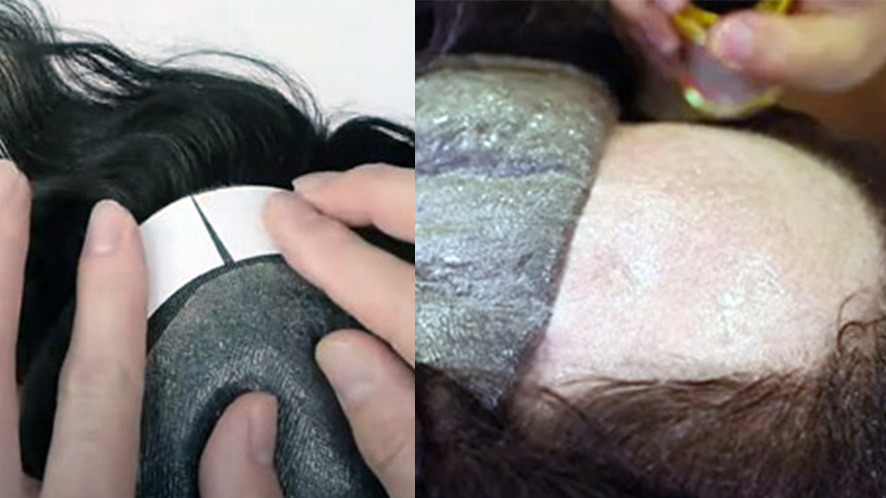 A GUIDE TO NON-SURGICAL HAIR REPLACEMENT SYSTEM (13)