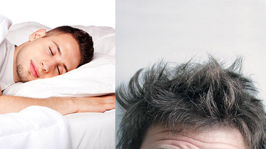 A GUIDE TO NON-SURGICAL HAIR REPLACEMENT SYSTEM (19)
