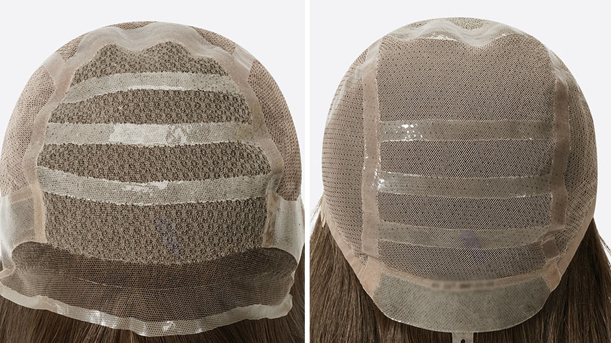 Basic Guide of Cranial Prosthesis aka Medical Wigs (16)