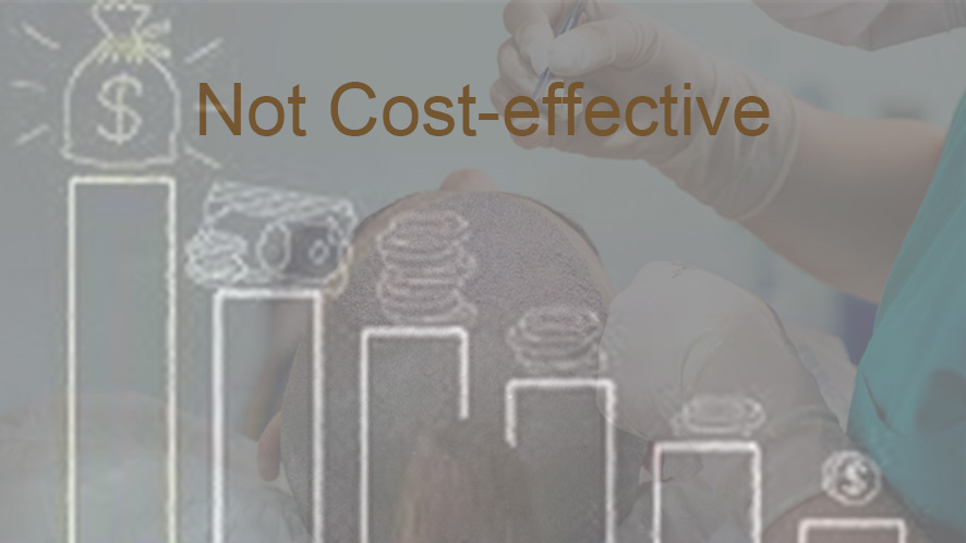 Men Hair Transplant (8)
