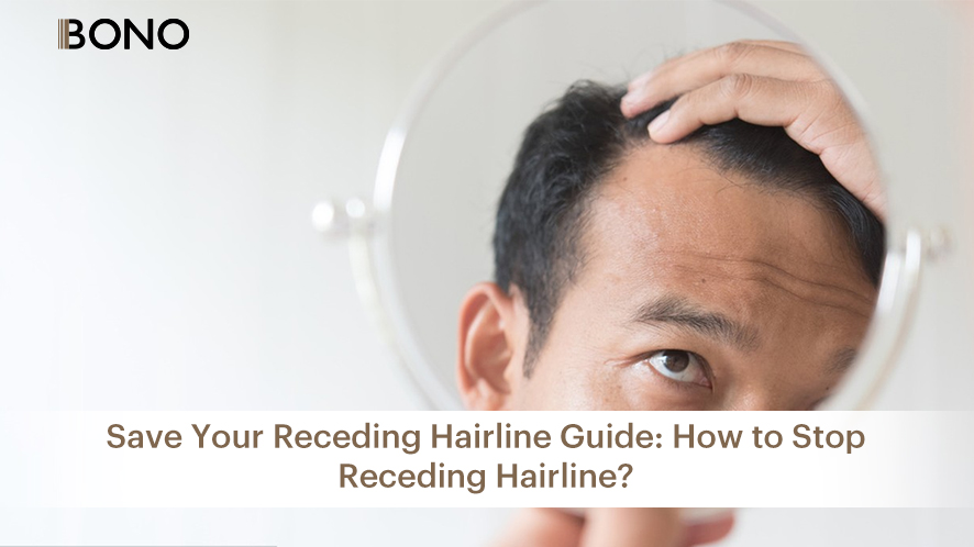 hairline receding (17)