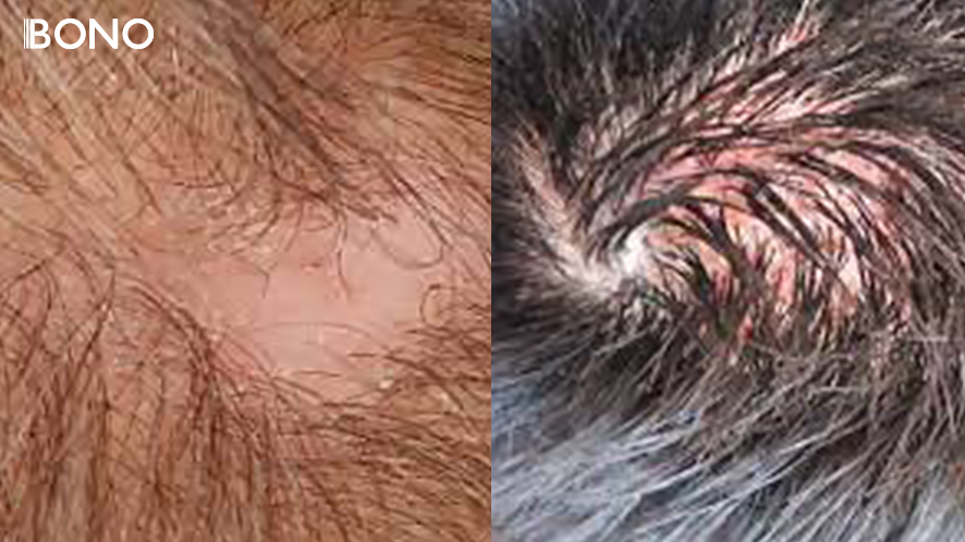 10 causes of hair losses.edited.edited (7)