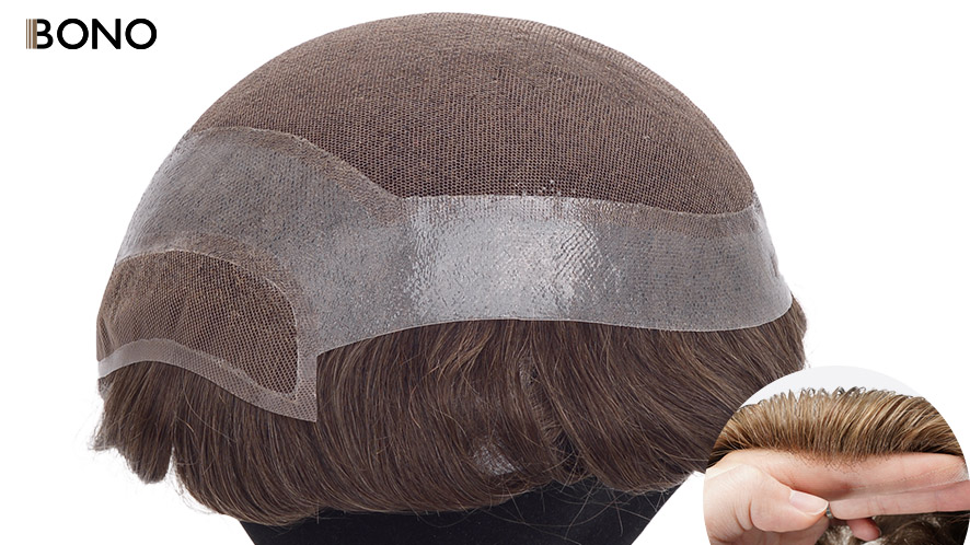 Wondering How to Solve Types of Baldness (3)