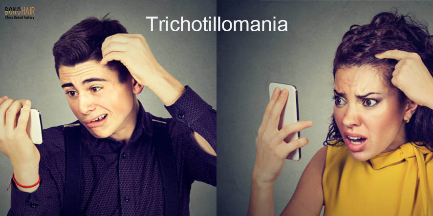 What is Alopecia and Alopecia Treatment (11)