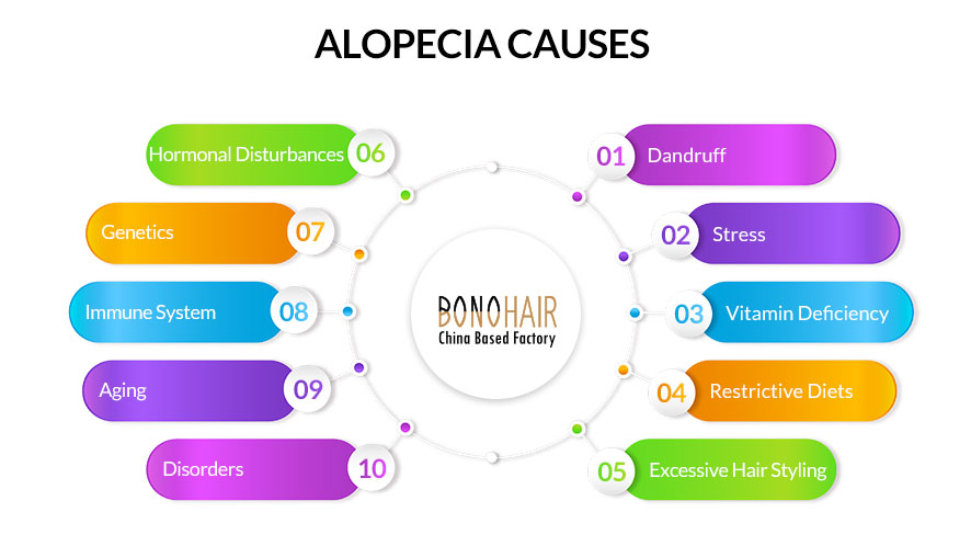 What is Alopecia and Alopecia Treatment (14)