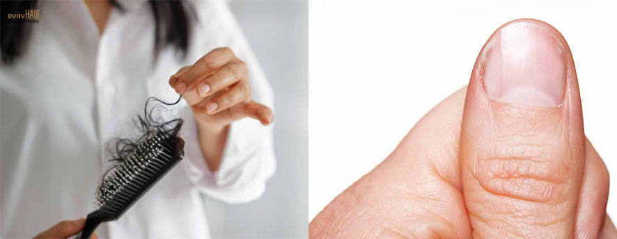 What is Alopecia and Alopecia Treatment (18)