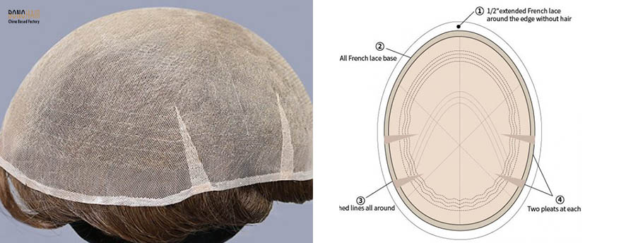 What is Alopecia and Alopecia Treatment (22)