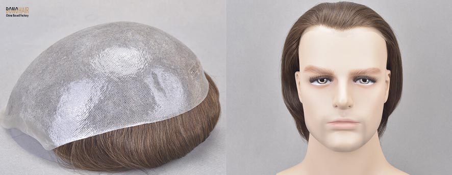 What is Alopecia and Alopecia Treatment (25)