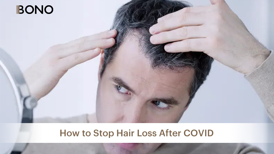 Hair Loss after COVID (5)