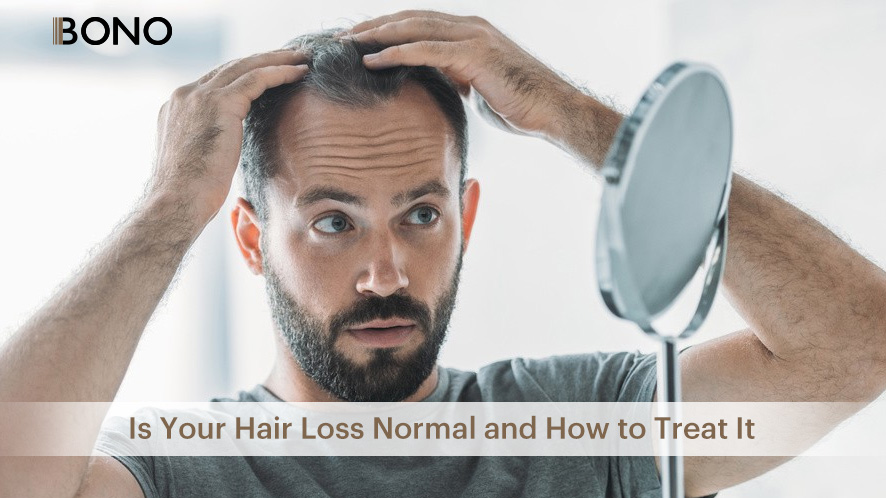Is Your Hair Loss Normal and How to Treat It (2)