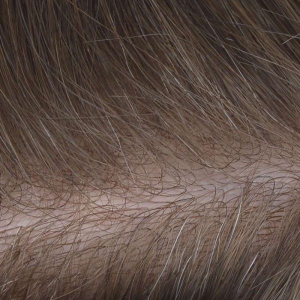 Scallop Front Skin Hair Replacement Is Skin Hair Prosthesis From Bono Hair