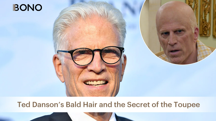 Is Ted Dansom Bald (6)