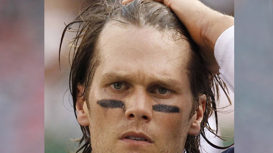 When Did Tom Brady Go Bald